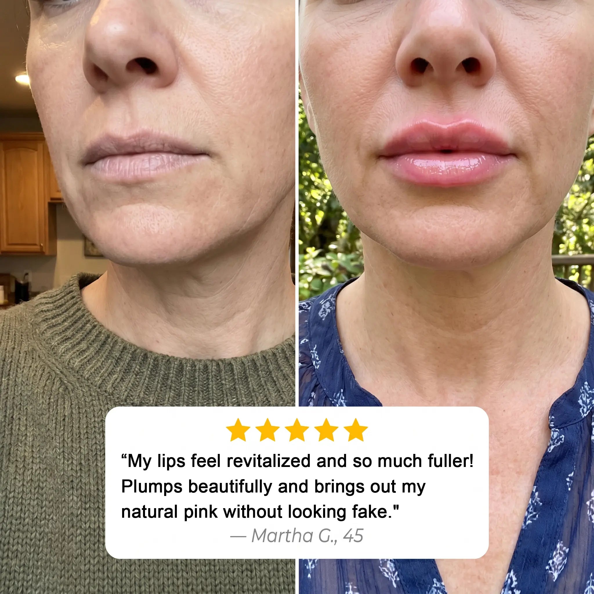 Miniaturetreee™ Bio-Spicule Plumping Lip Serum - Instant Natural Plump & 24/7 Glass-Like Hydration | Claim 90% OFF Today🔥