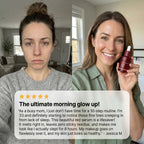 Miniaturetreee™ NAD+ Vitality Firming Serum - Visibly Smooths & Deeply Hydrates for a Radiant Glow | Claim 90% OFF🔥
