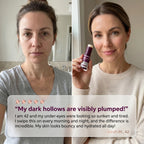 Miniaturetreee™ Calcium Glow Multi Balm - Visibly Plumps & Deeply Hydrates for a Radiant Finish | Last day Claim 90% OFF🔥